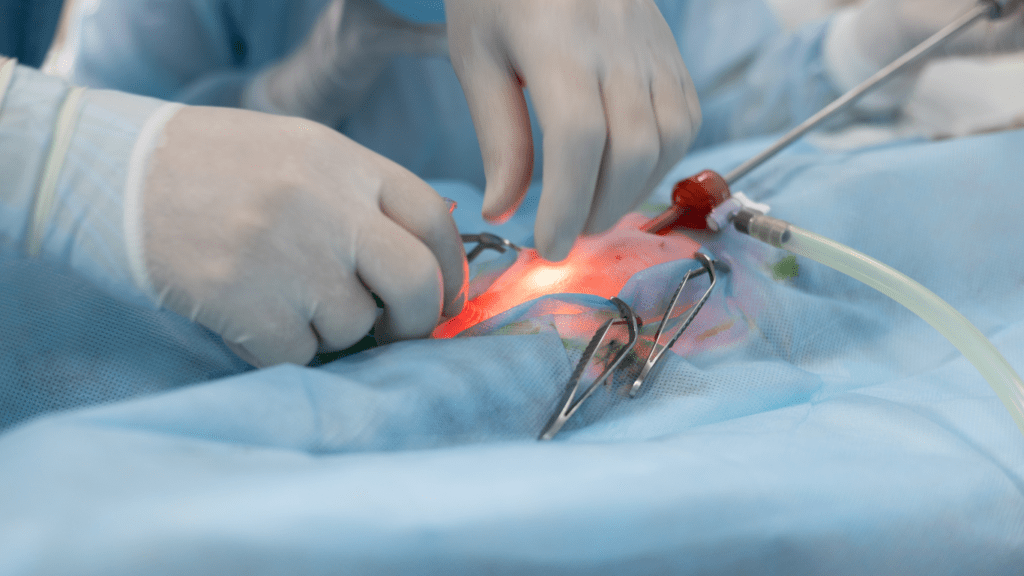 a surgeon is performing an operation on a patienta surgeon is performing an operation on a patient